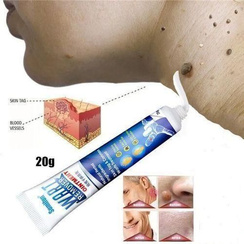 Sumifun Skin Tag Remover Wart Remover Moles Remover Repair Cream